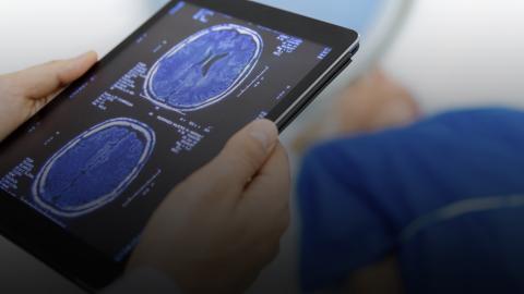 Teknisi radiologi memegang hasil pemindaian otak pasien